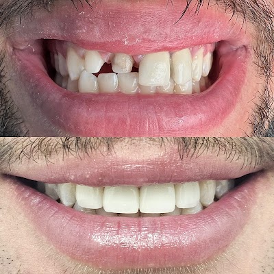 Coconut Creek Cosmetic and Implant Dentistry